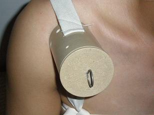 供應(yīng)灸療導(dǎo)入器艾灸風(fēng)濕病