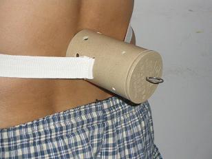 灸療導(dǎo)入器艾灸骨傷痛