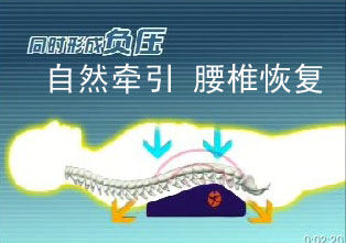 椎間盤突出治療儀