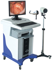 數(shù)碼電子陰道鏡 最**