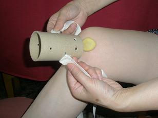 家用艾灸儀風(fēng)寒痹痛隔姜灸