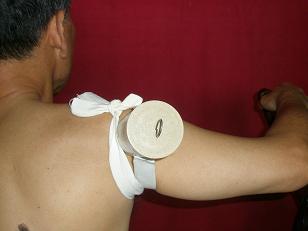 灸療導(dǎo)入器艾灸消腫散結(jié)