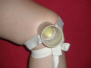 供應(yīng)灸療導(dǎo)入器艾灸關(guān)節(jié)痛