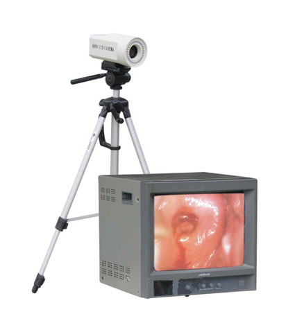 數(shù)碼電子陰道鏡