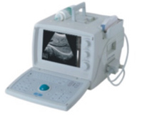 便攜式B超診斷儀