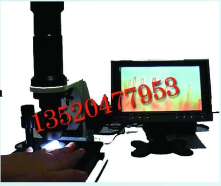北京廠家制造微循環(huán)檢測儀彩色電視型