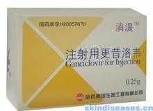 注射用更昔洛韋