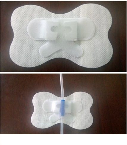 微管式引流管固定裝置