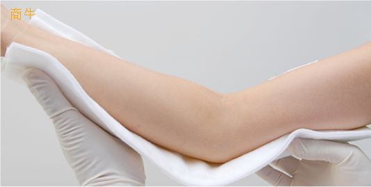 高分子夾板、醫(yī)用高分子夾板