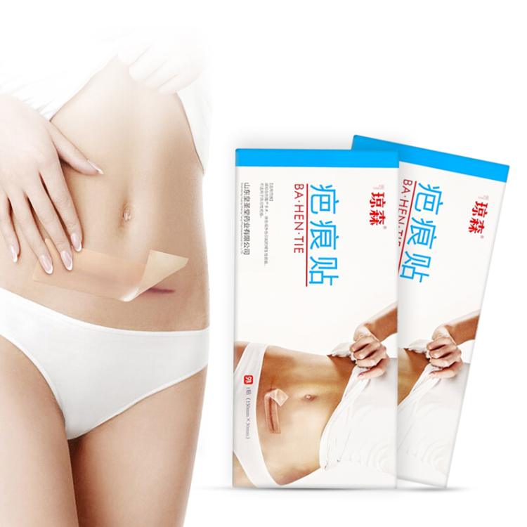 瓊森疤痕貼手術(shù)疤痕