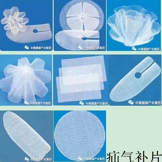 疝修補(bǔ)補(bǔ)片，平片，網(wǎng)塞，帶精索控